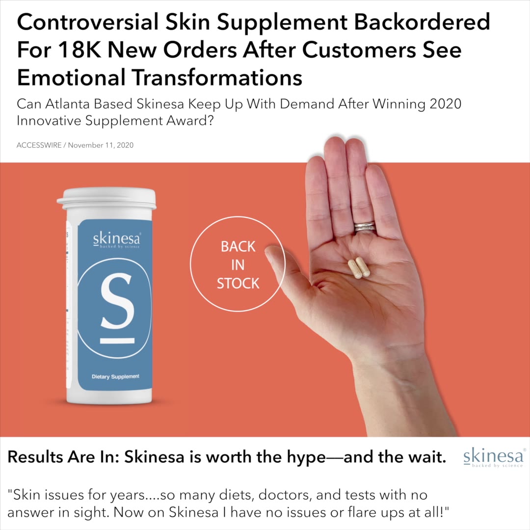 Skinesa Facebook ad