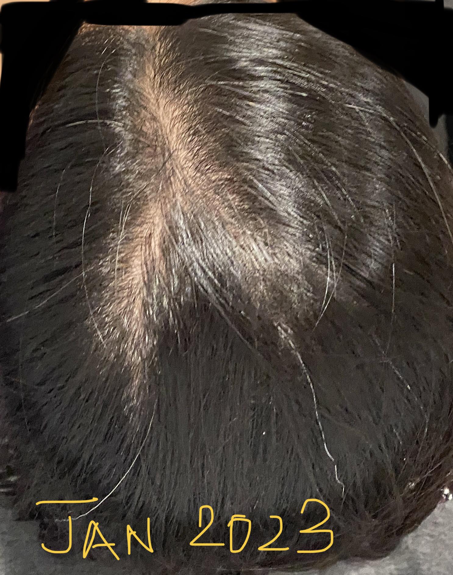 Cassie McCarthy Facebook ad: My sister's perimenopause hair loss stopped in 3 months…