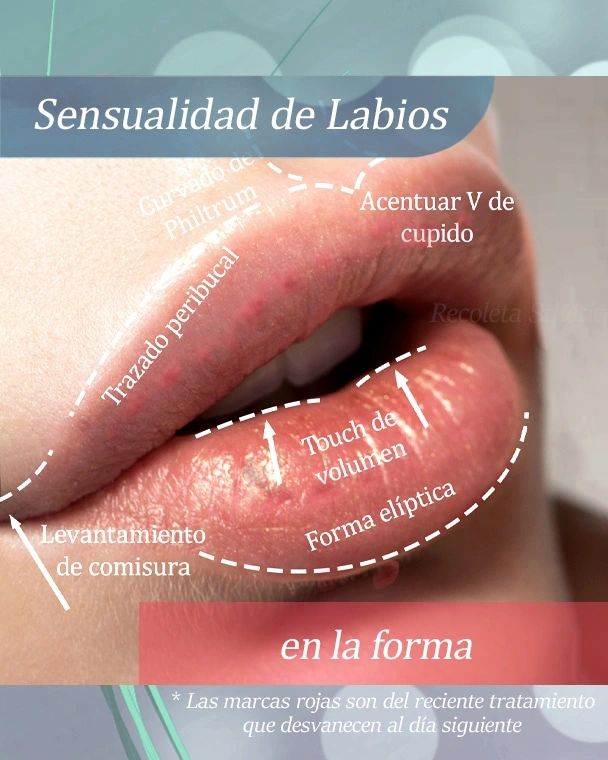Recoleta Sthetic Facebook ad