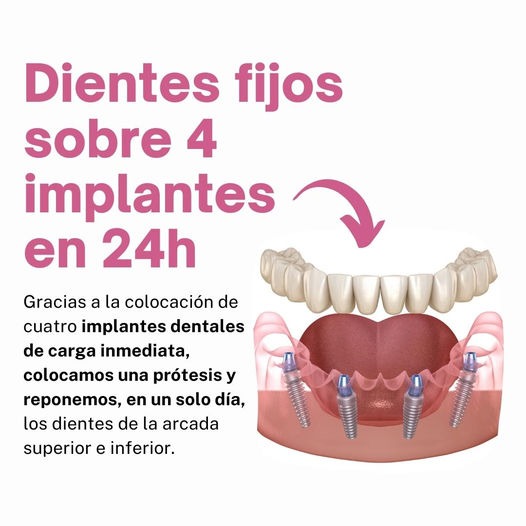 Grupo Dental Clinics Facebook ad: Clínica Dental en Roquetas de Mar