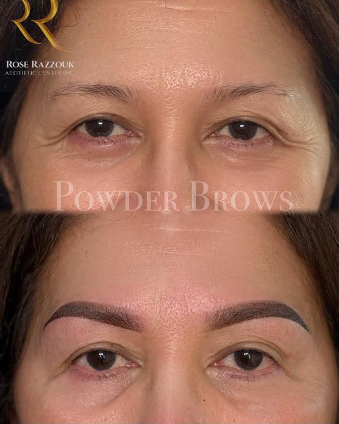 Rose Razzouk Aesthetic Center Inc. Facebook ad: Flawless brows that last.