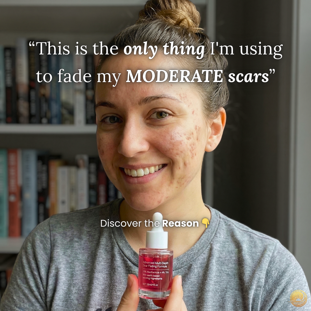 Autumn Rose Facebook ad: I Learned This After Some Many Fails