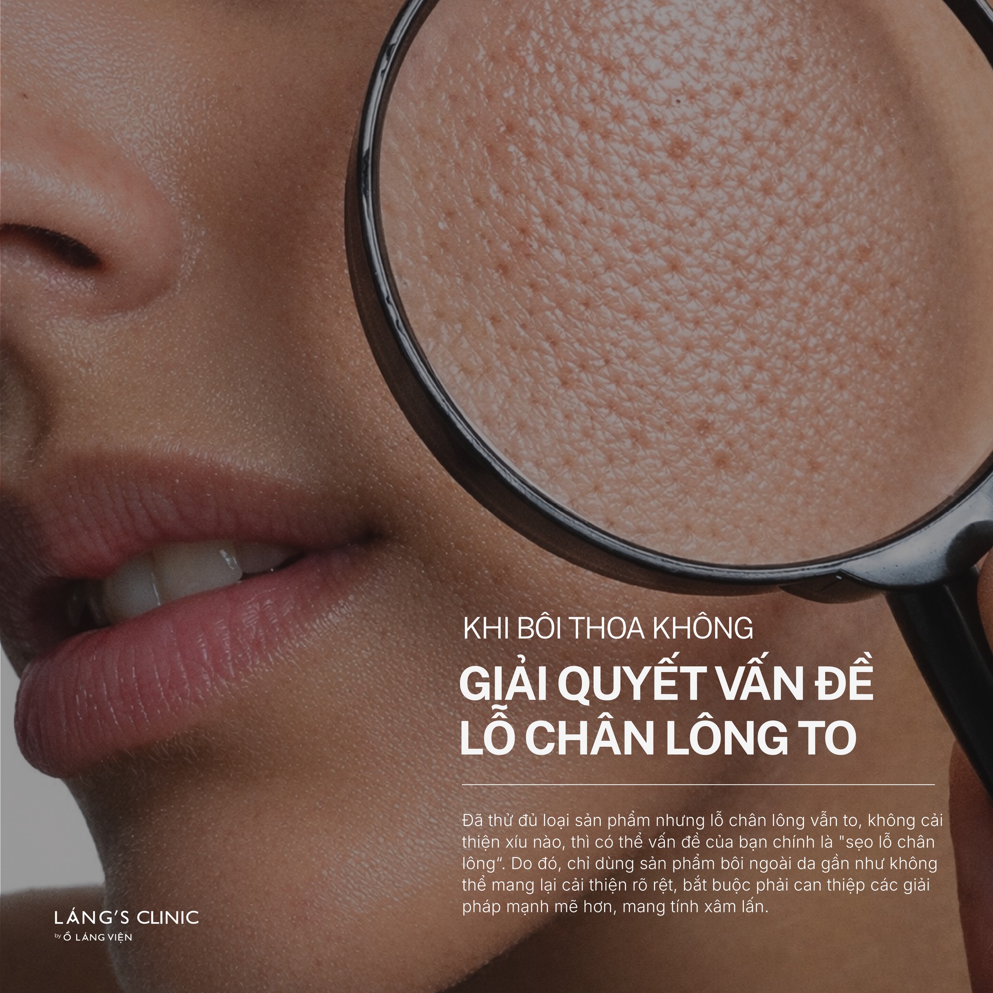 Ồ Láng Viện Facebook ad