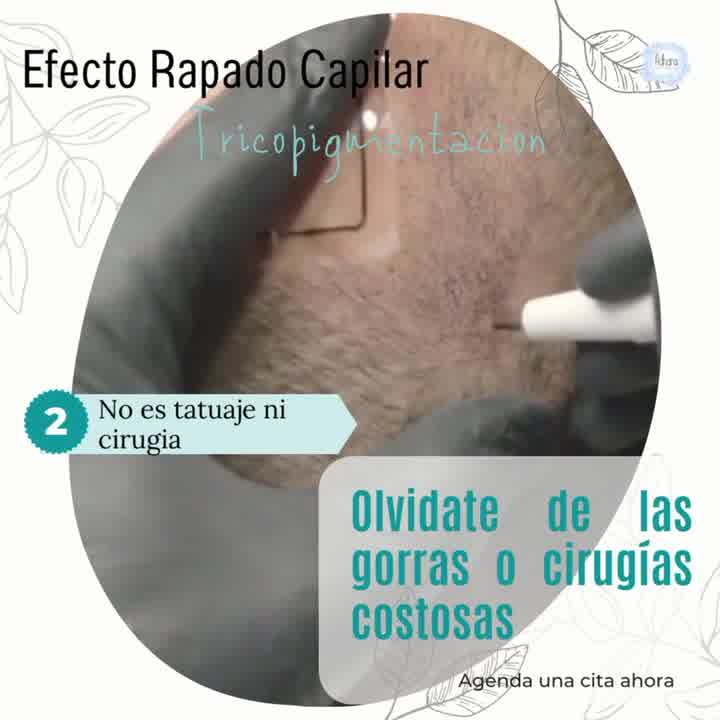 Adhara Esthetic Facebook ad: ¡Olvídate de la calvicie!