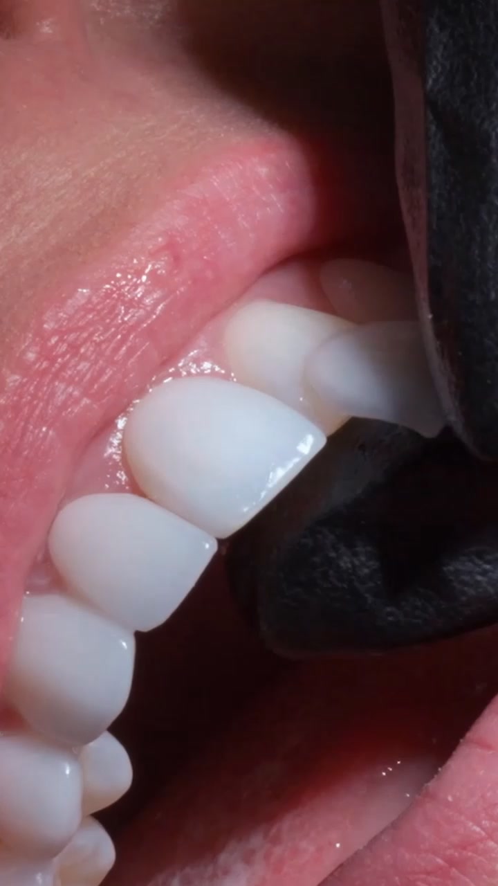 Dr.Laleh Mehrrafiee Facebook ad: The Secret To Celebrity Smiles!