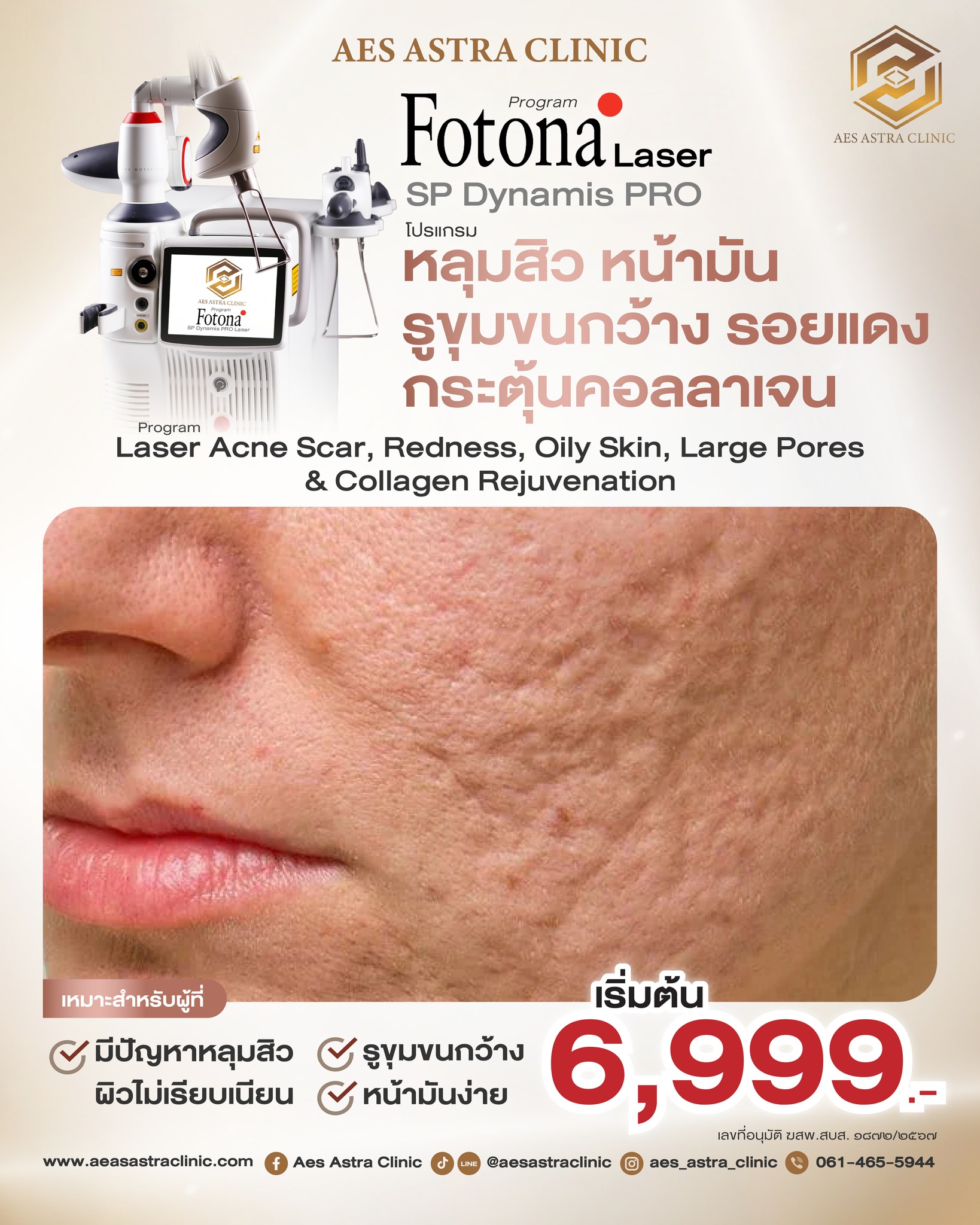 Aes Astra Clinic Facebook ad