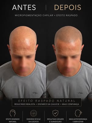 Augusto Cazella - Dermopigmentador Facebook ad: � O detalhe faz toda diferença.