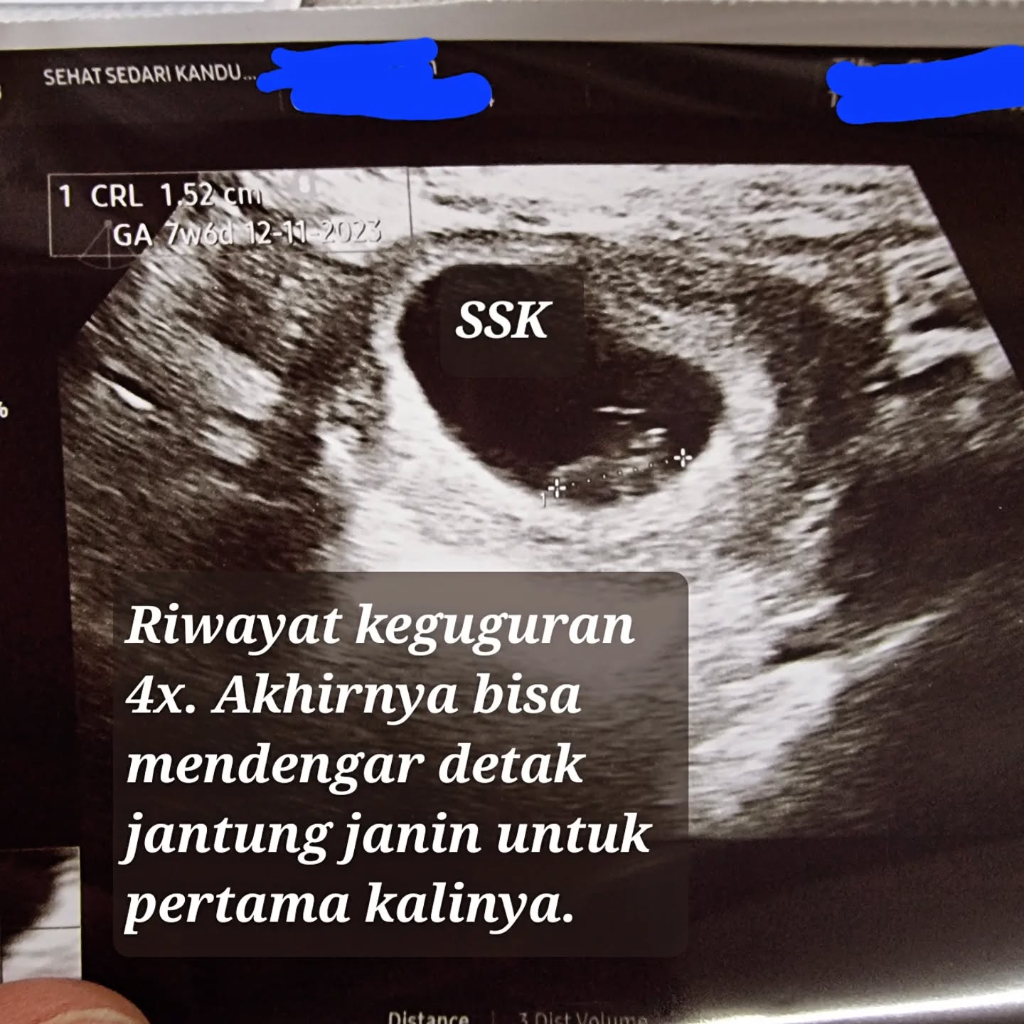 drphilipspog Facebook ad: KEGUGURAN. Jika terjadi keguguran minimal 2x berturut2…