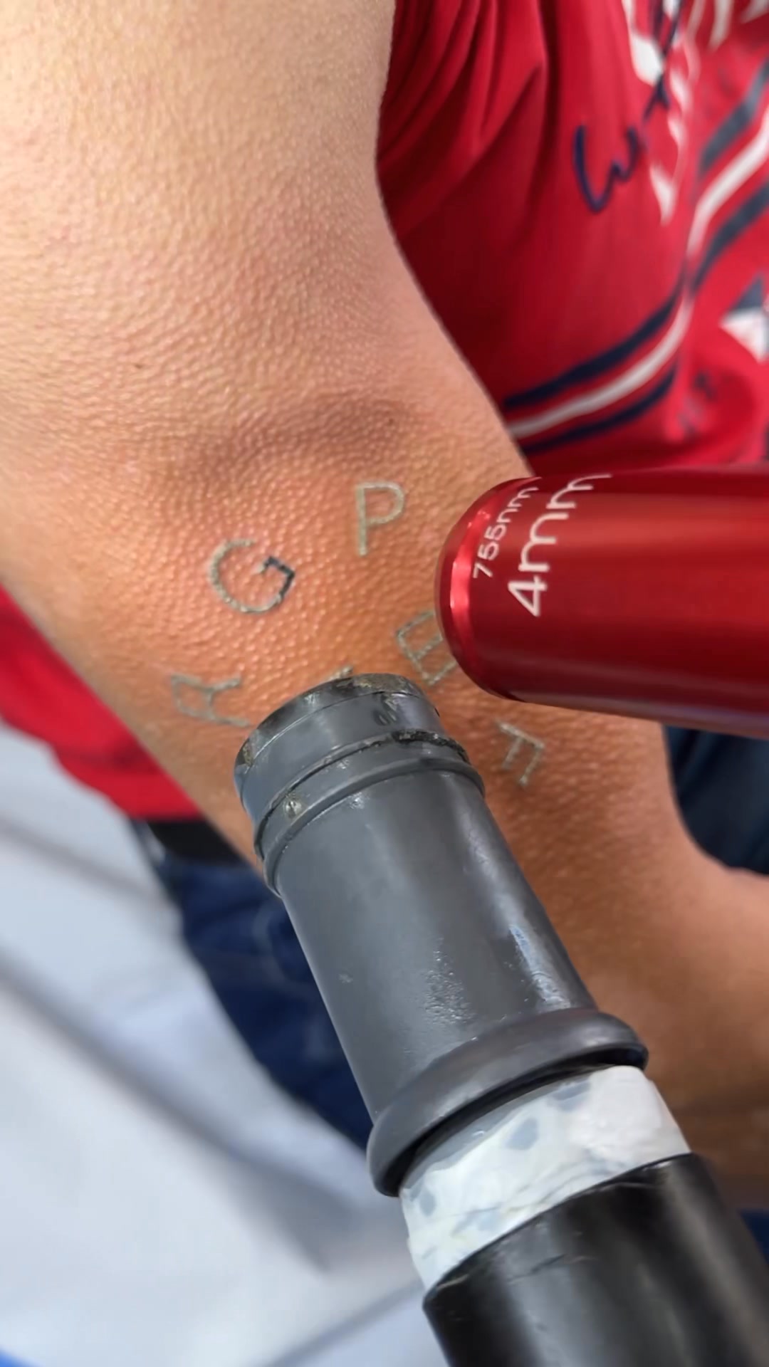 Kostas Laser Center Facebook ad: New pico laser tattoo removal Alex triVantage Candela…