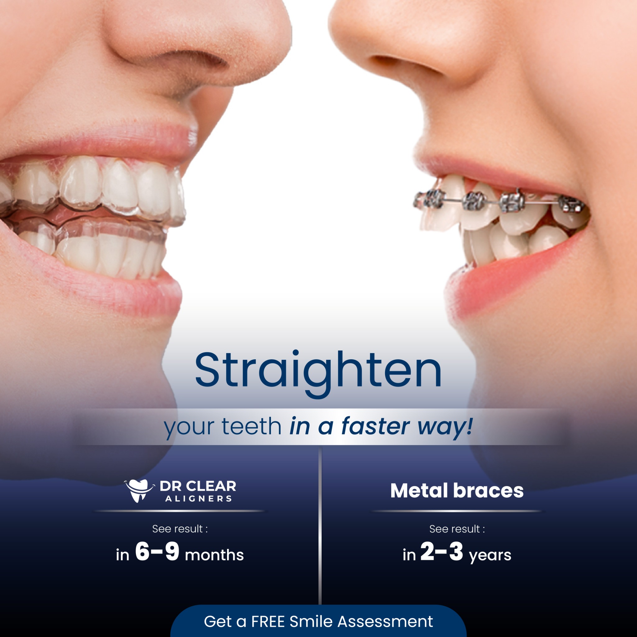 Dr Clear Aligners MY Facebook ad