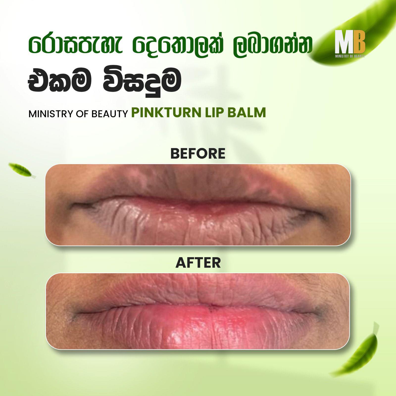 PinkTurn - Ministry of Beauty Facebook ad: දෙතොල් කළු වෙලා, වියළි වෙලා නිසා, ඔයාගෙ දෙතොල්…