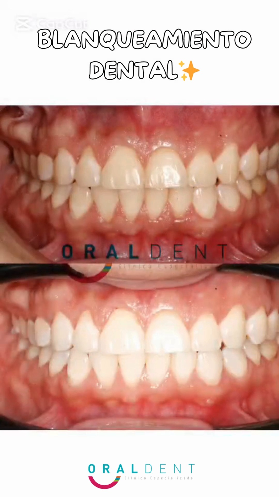 Oral Dent Facebook ad: Este es un tratamiento que nos permite aclarar…