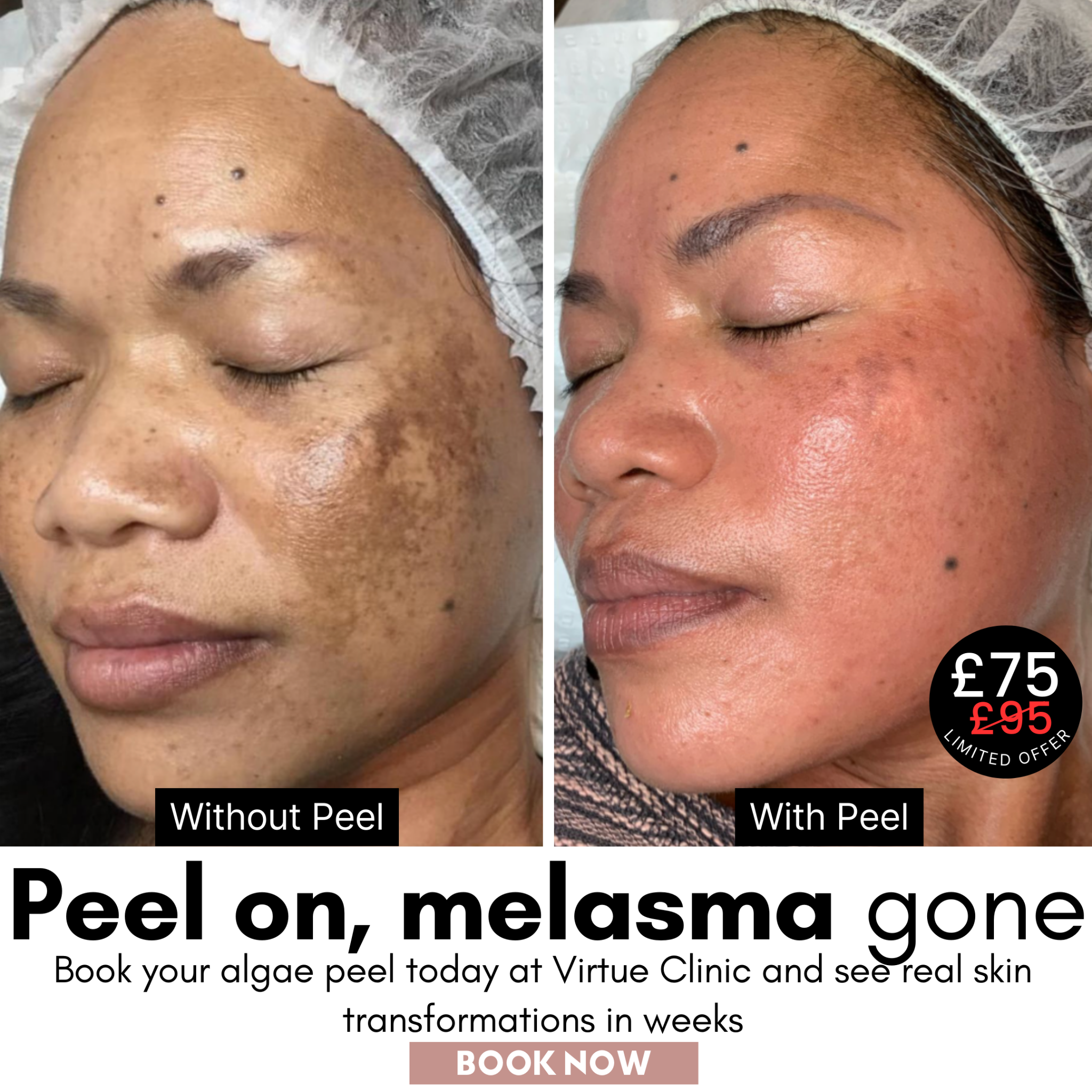 Virtue Aesthetic Treatments Facebook ad
