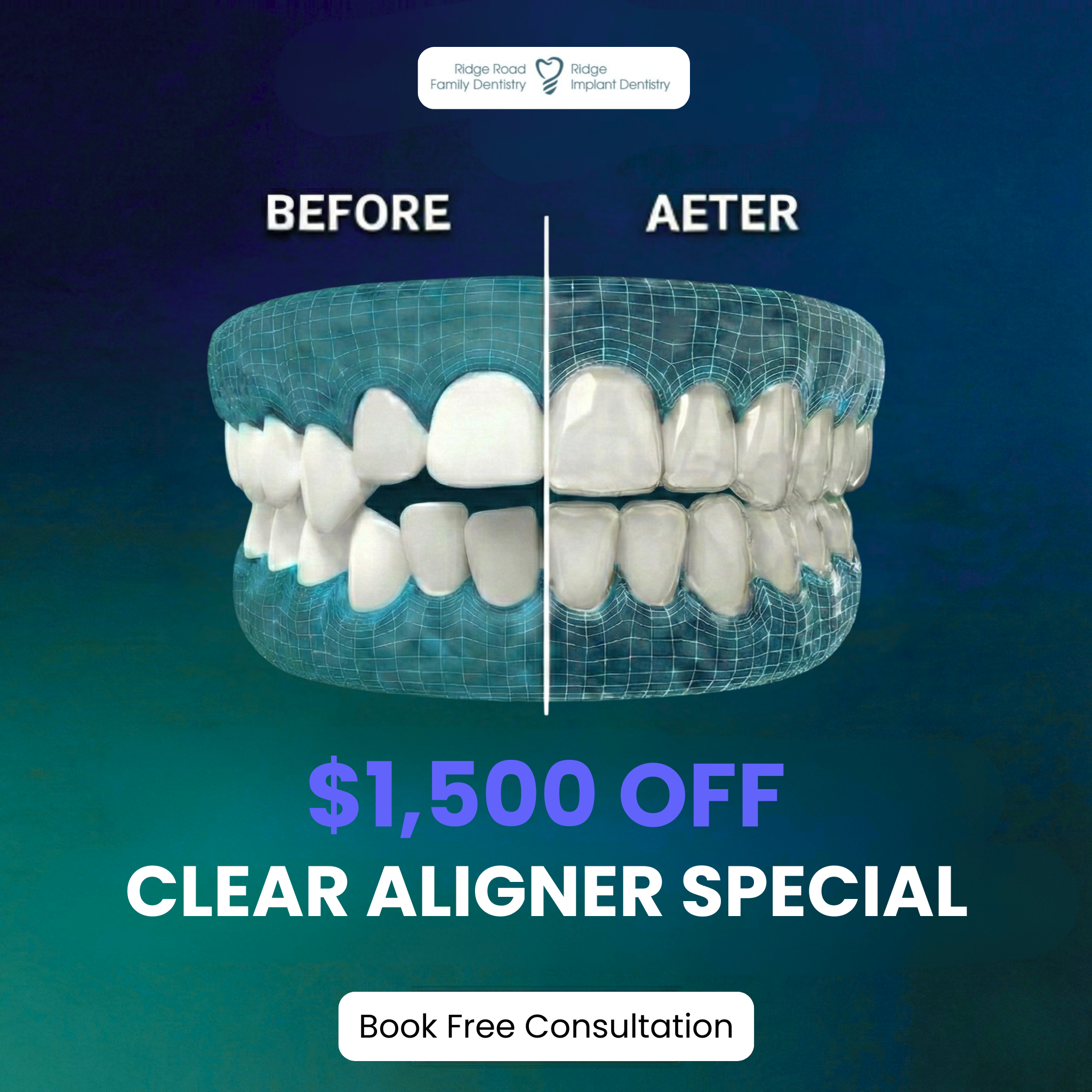 Ridge Road Family Dentistry Facebook ad: Hey Cleveland! New Year Special $1500 OFF Clear Aligner is…