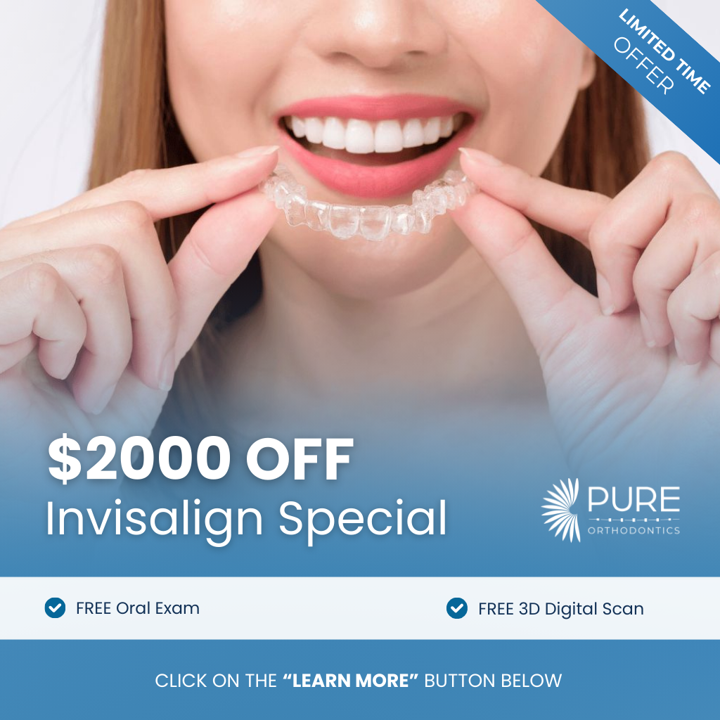 Pure Orthodontics Facebook ad