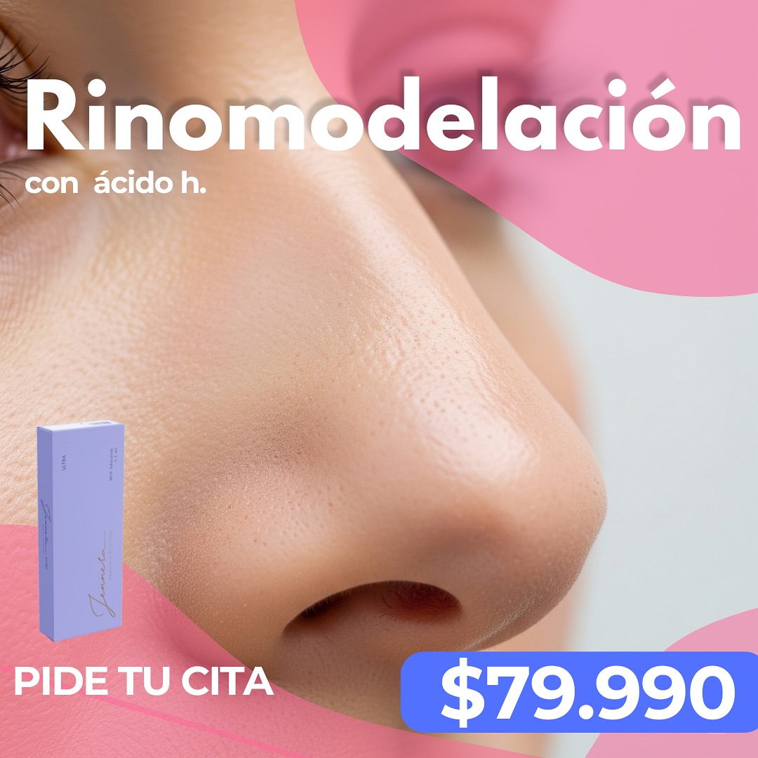 Clínica Rêve Facebook ad