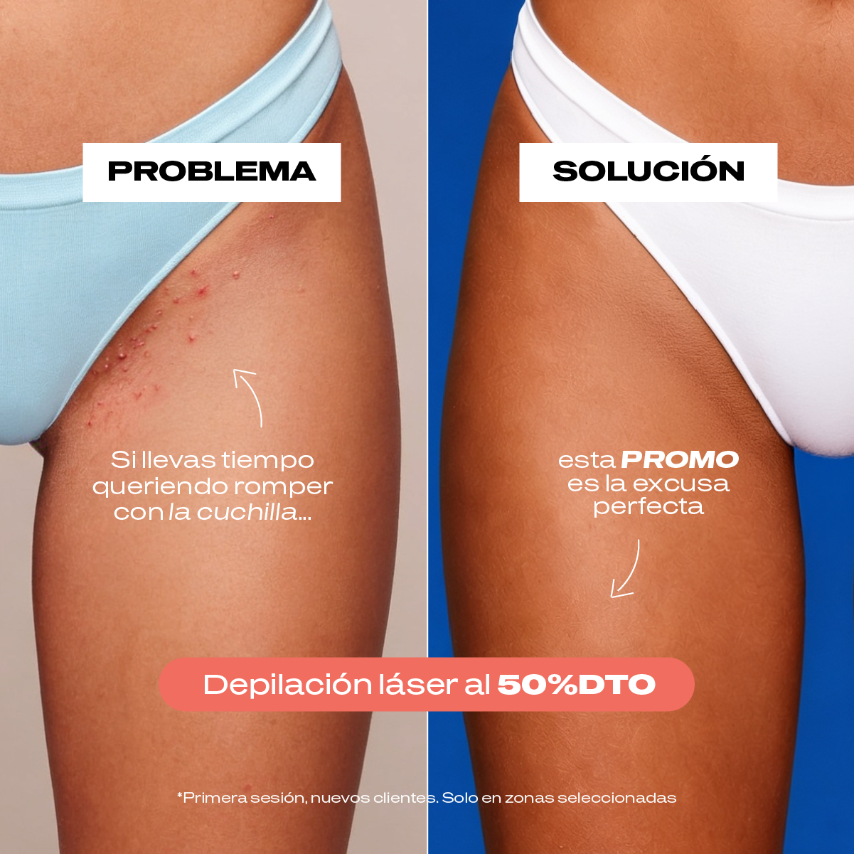Láserum Facebook ad: Da el paso con un 50% dto