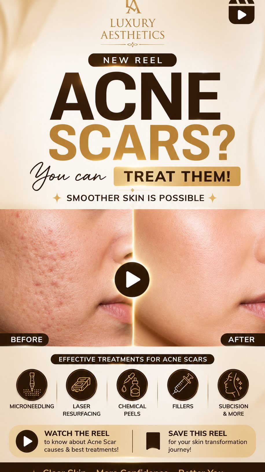 Luxury Aesthetics Panchsheel Park Facebook ad: Feel Like Your Best Self