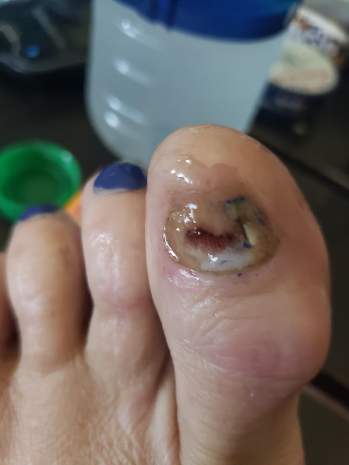A. Elisabeth Smith Facebook ad: If you have nail fungus, you'll want to try this
