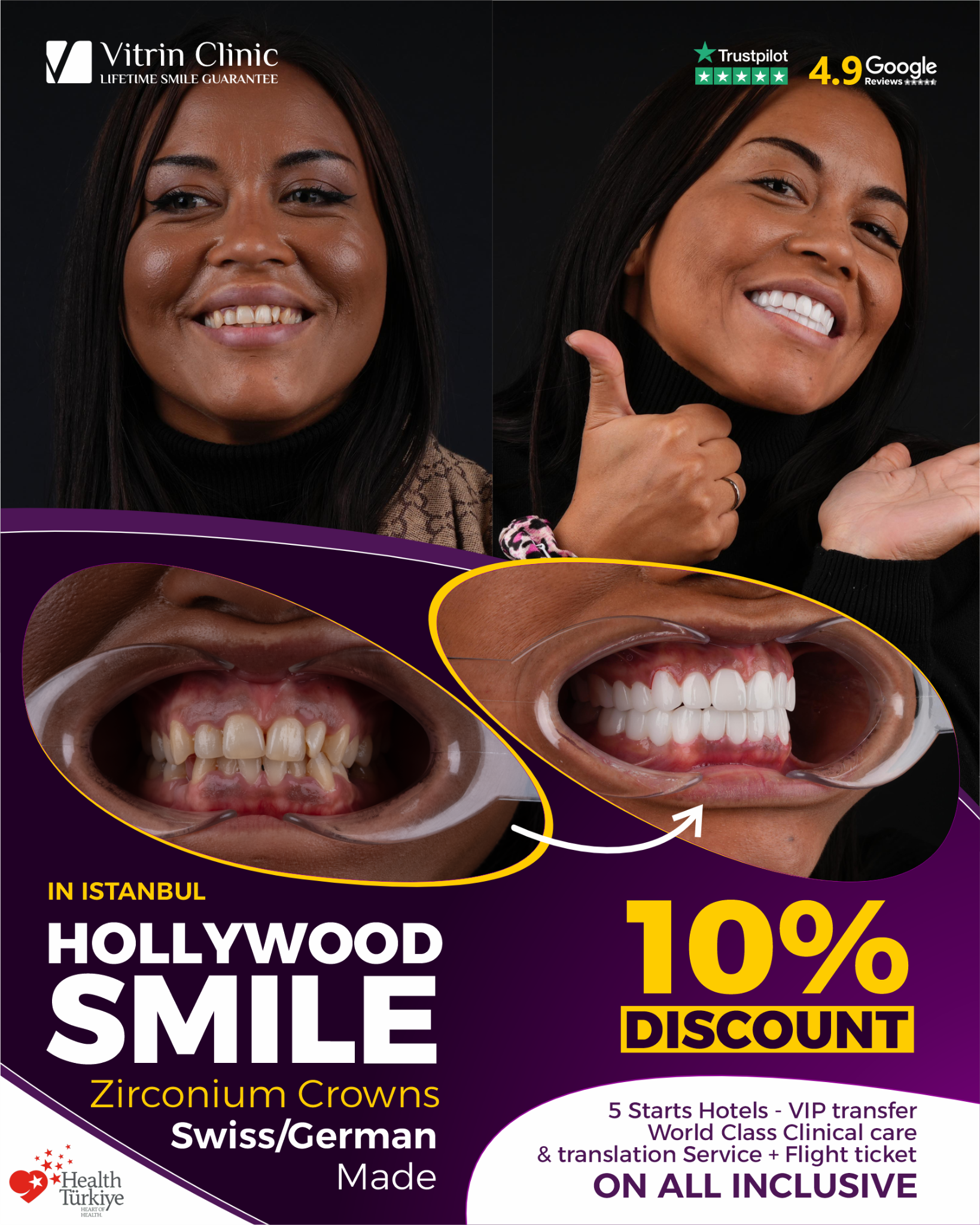 Vitrin Dental Clinic Facebook ad