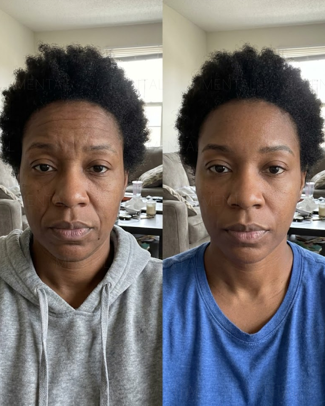 Mimika - Face Yoga Exercises Facebook ad