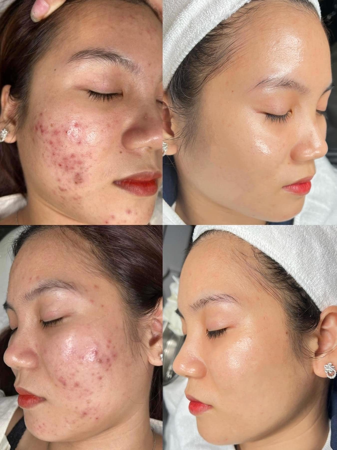 Nado Clinic Davao Facebook ad