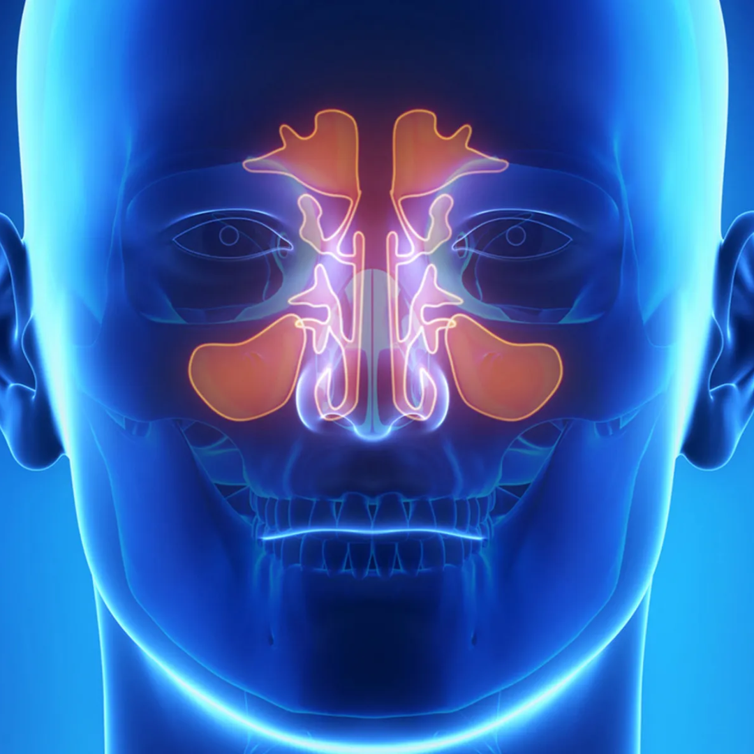 Linda Moore Facebook ad: Sinusitis? Read This
