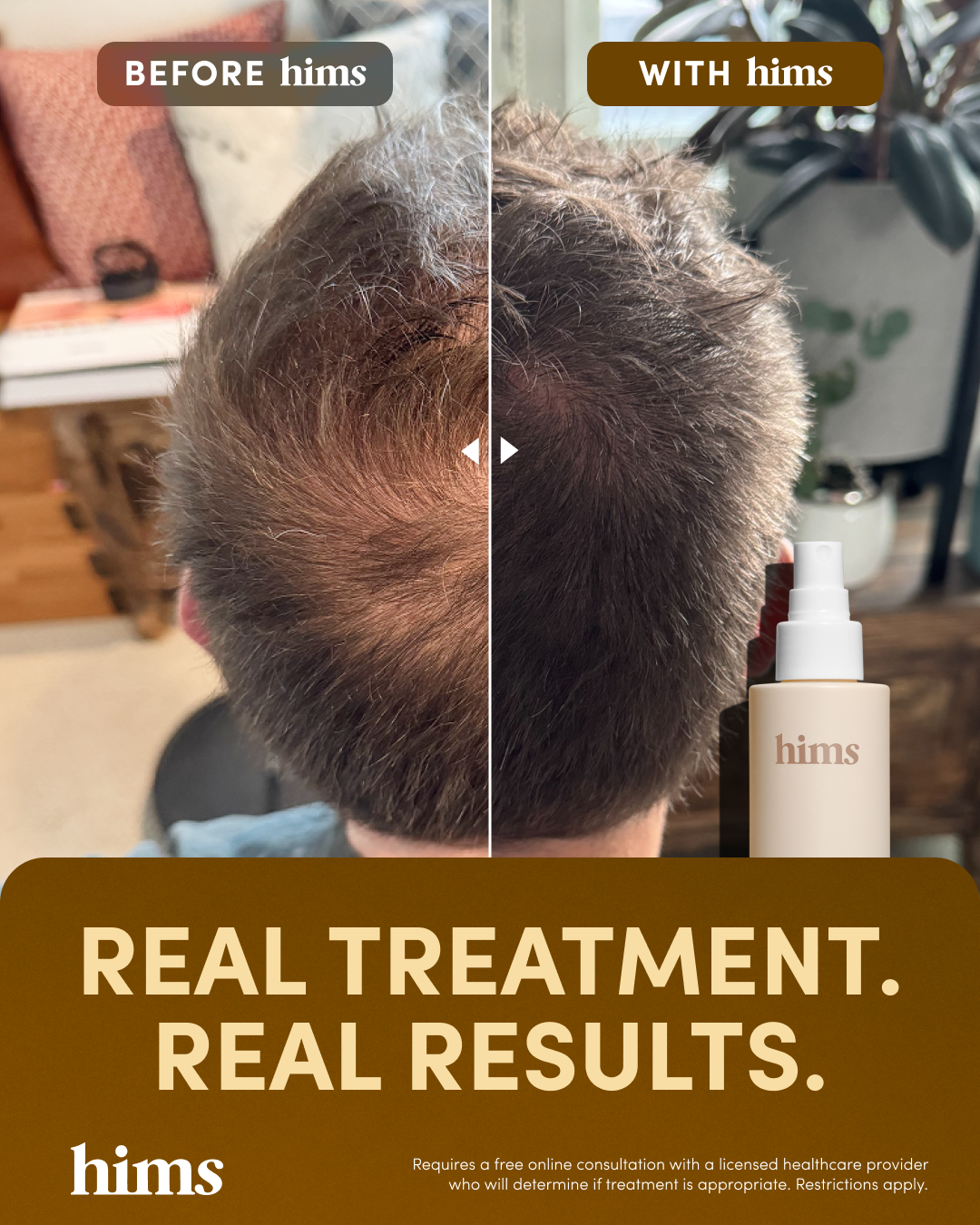 hims Facebook ad