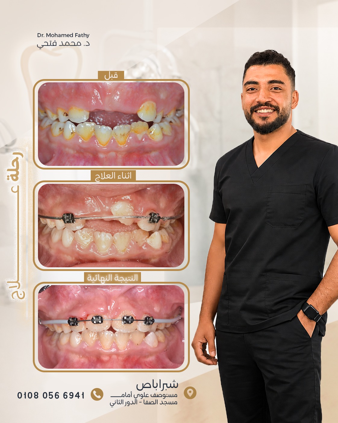 Dr Smile Dental clinic - د/محمدفتحي أبوالنصر Facebook ad: رحلة العلاج الصحيحة، بتبدأ بتشخيص صح وبعد توفيق…