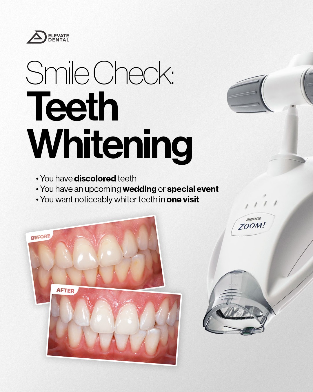 Elevate Dental PH Facebook ad: Your smile goals deserve the right treatment.