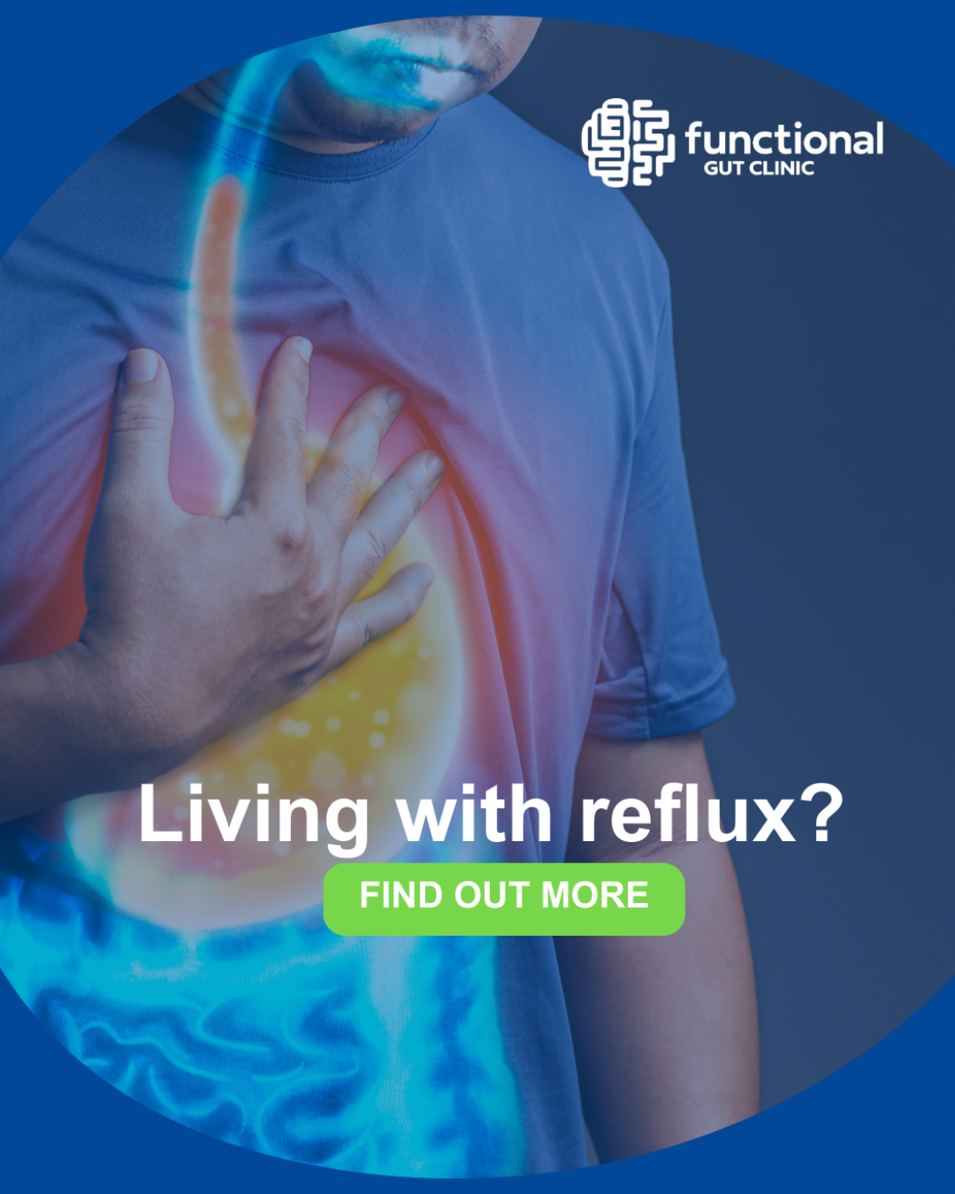 Functional Gut Facebook ad: Living with Acid Reflux?