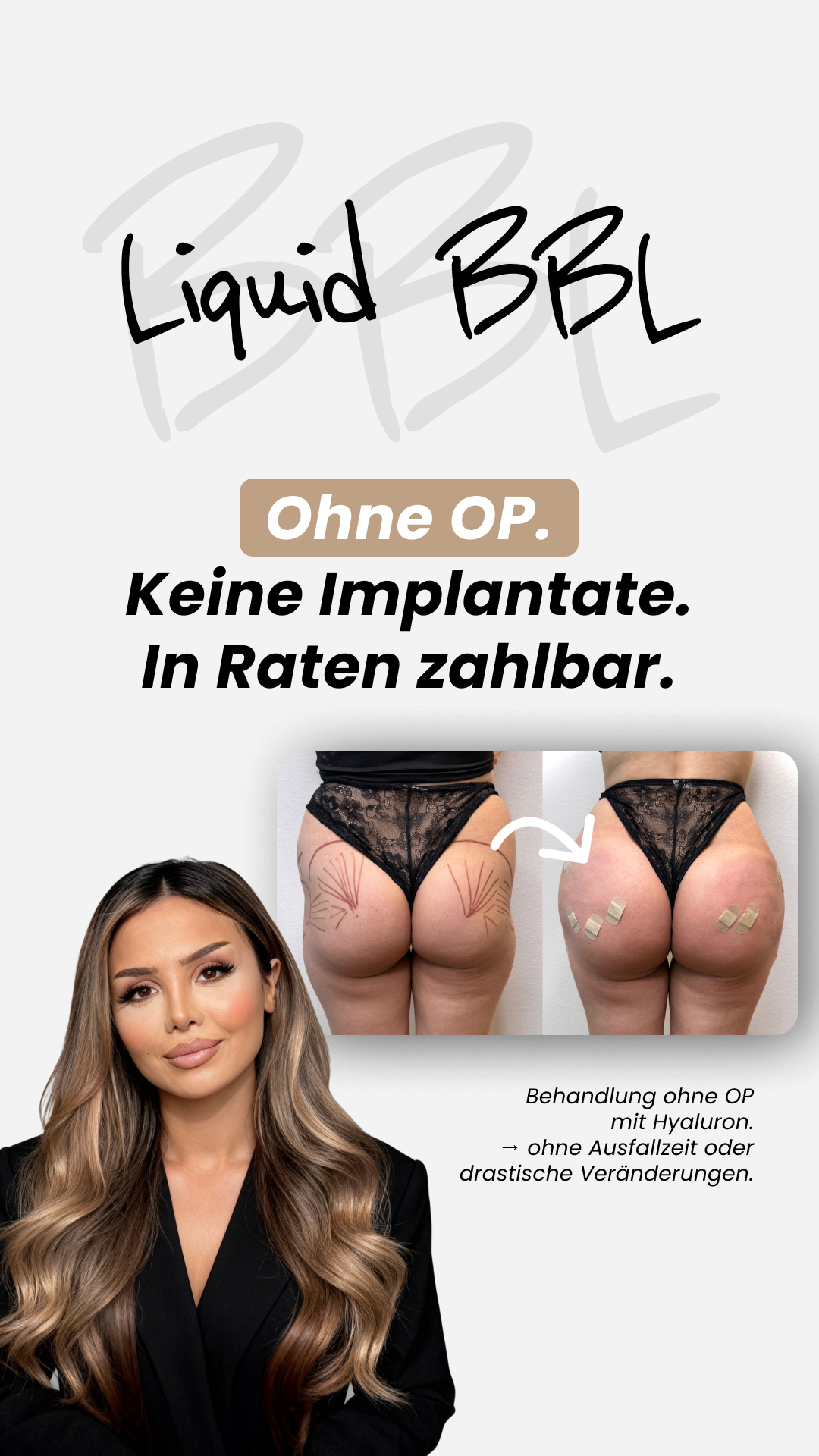 Medical skin Facebook ad: Kurven ohne OP - in Bremen!