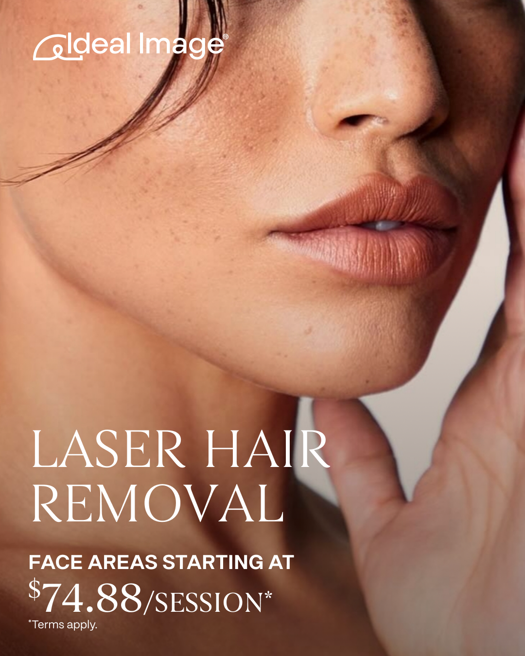 Ideal Image Facebook ad