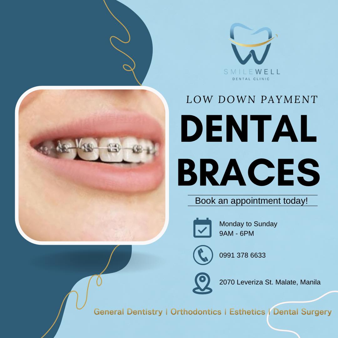 SmileWell Dental Clinic Facebook ad: Brace yourself for winning smiles