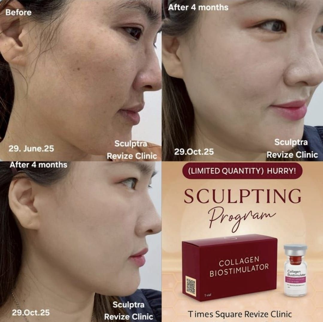 Revize Clinic Bangkok Facebook ad from Mar 18, 2026