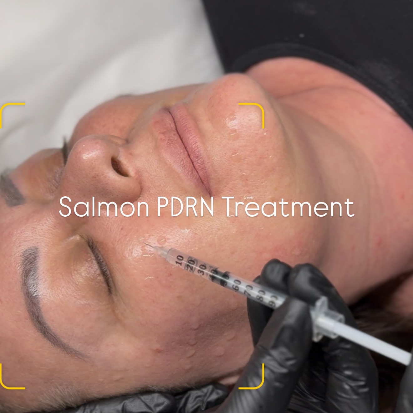 Skin And Laser Haus Facebook ad