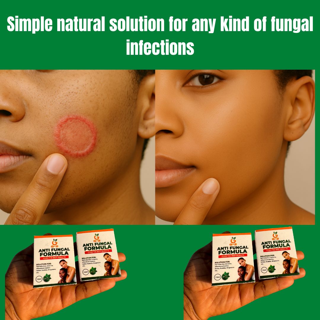Fungal Natural Remedy Facebook ad