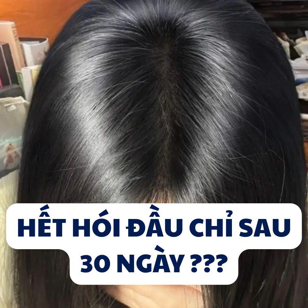 Chill Mỗi Ngày  Facebook ad