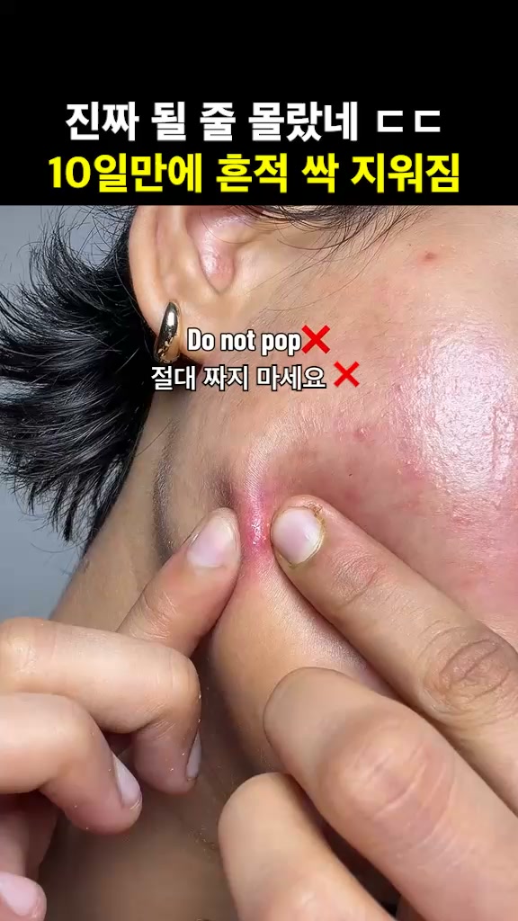 요즘핫템 Facebook ad: 미국을 뒤흔든 한국 약국템