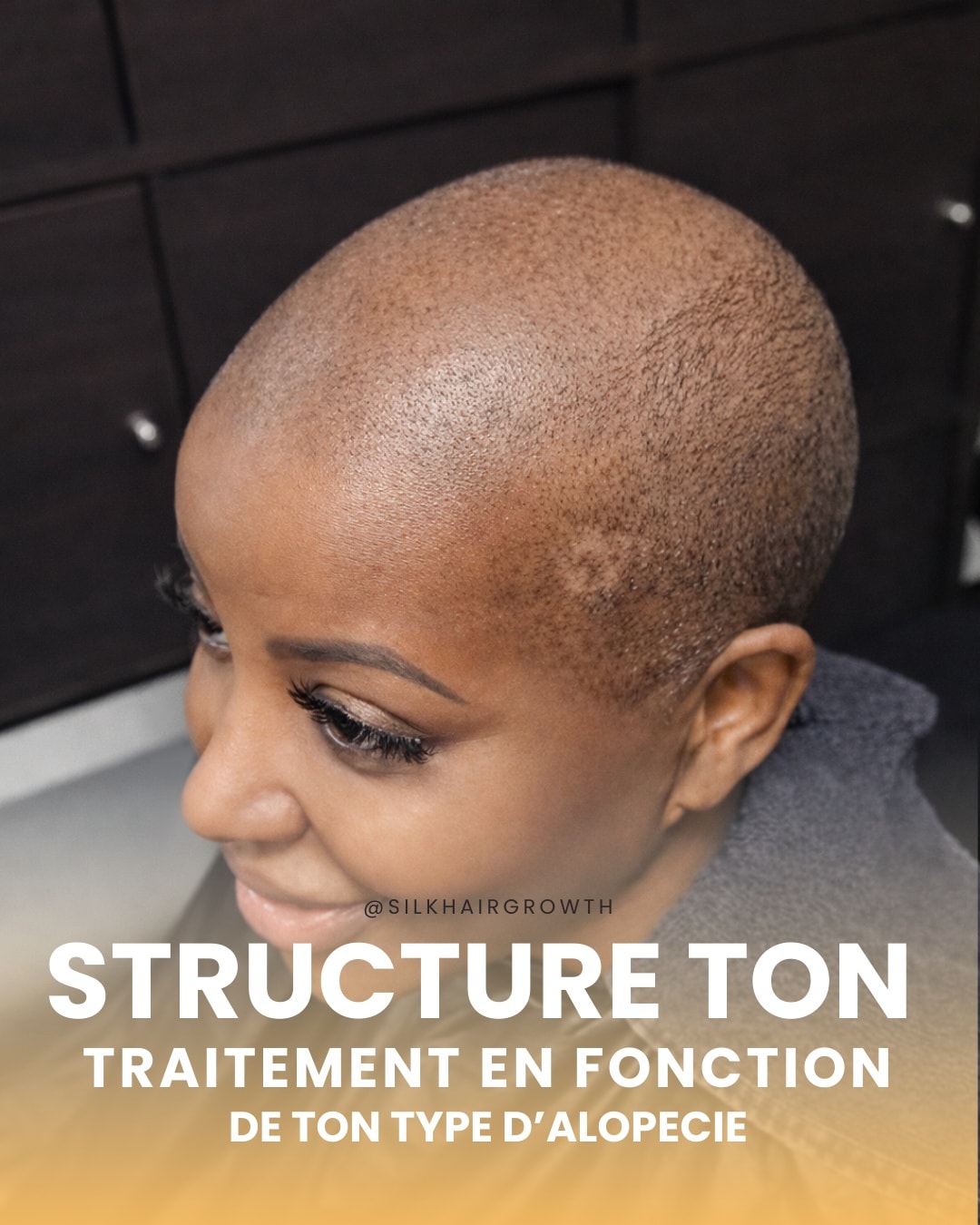 Silkhairgrowth Facebook ad: Tu penses que tu vas retrouver tes cheveux…