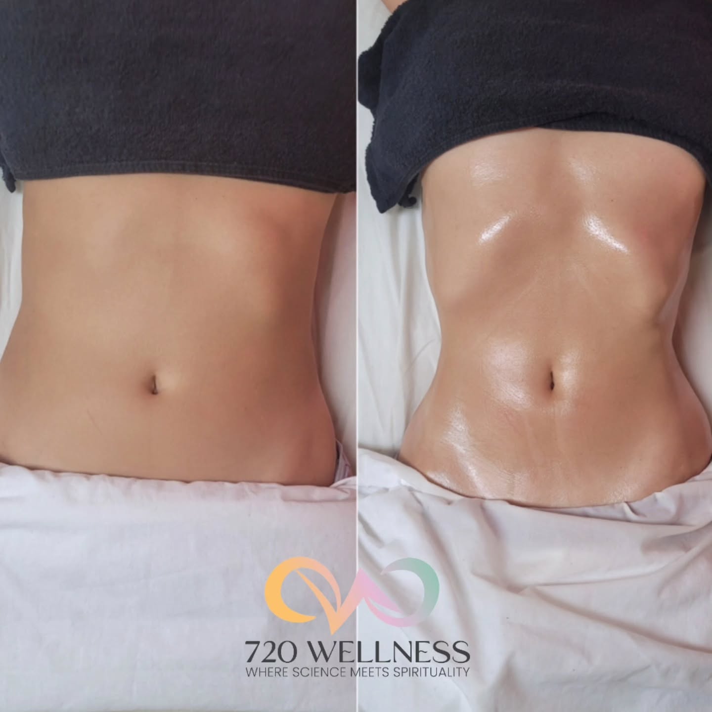 720wellness Facebook ad: BLOATED? STRESSED? HORMONES ALL OVER THE PLACE?