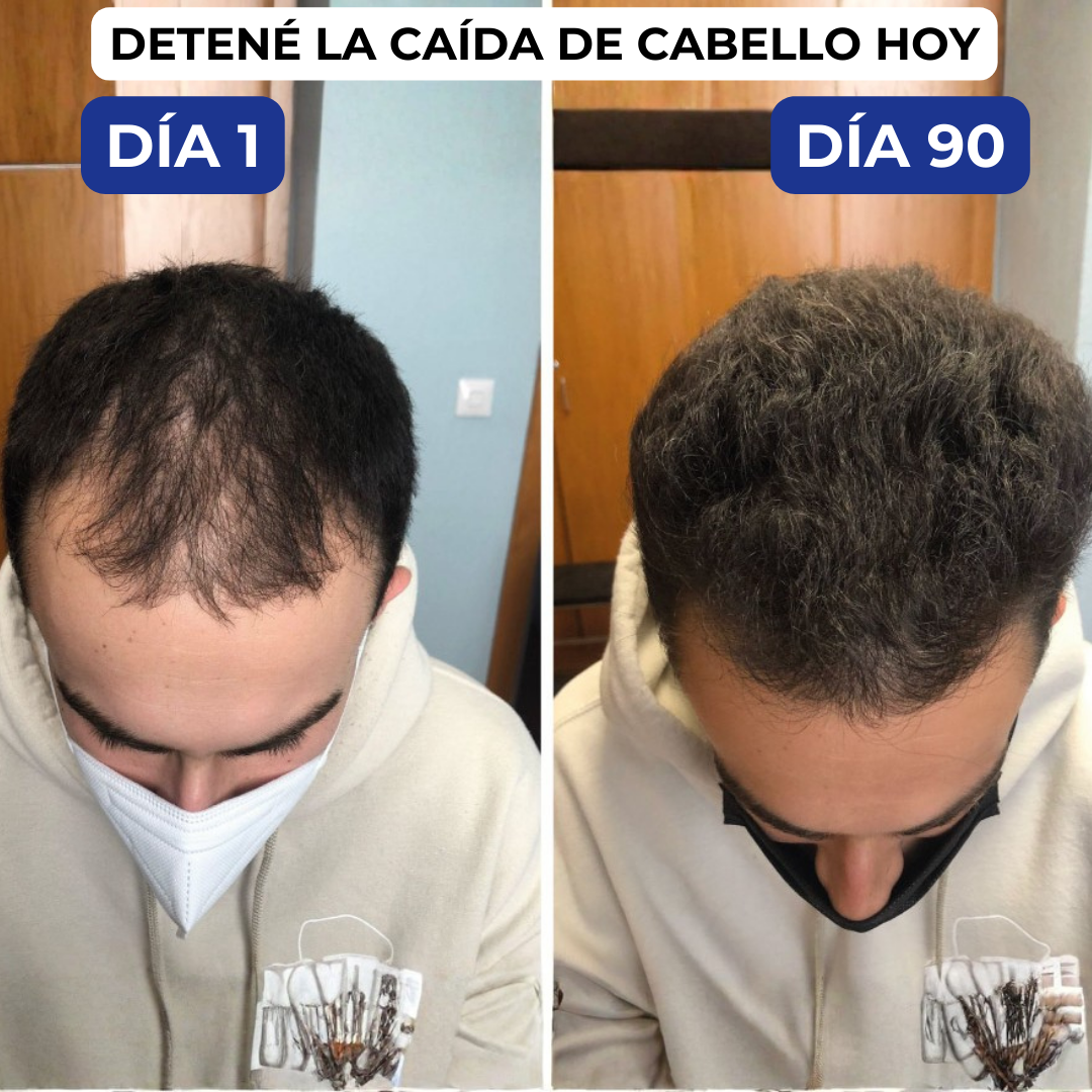 CapilNova Facebook ad: RESULTADOS O DEVOLUCION TOTAL