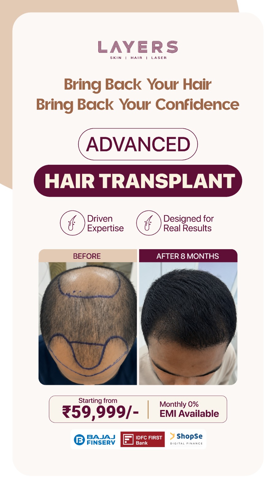 Layers Clinics - Skin & Hair Facebook ad
