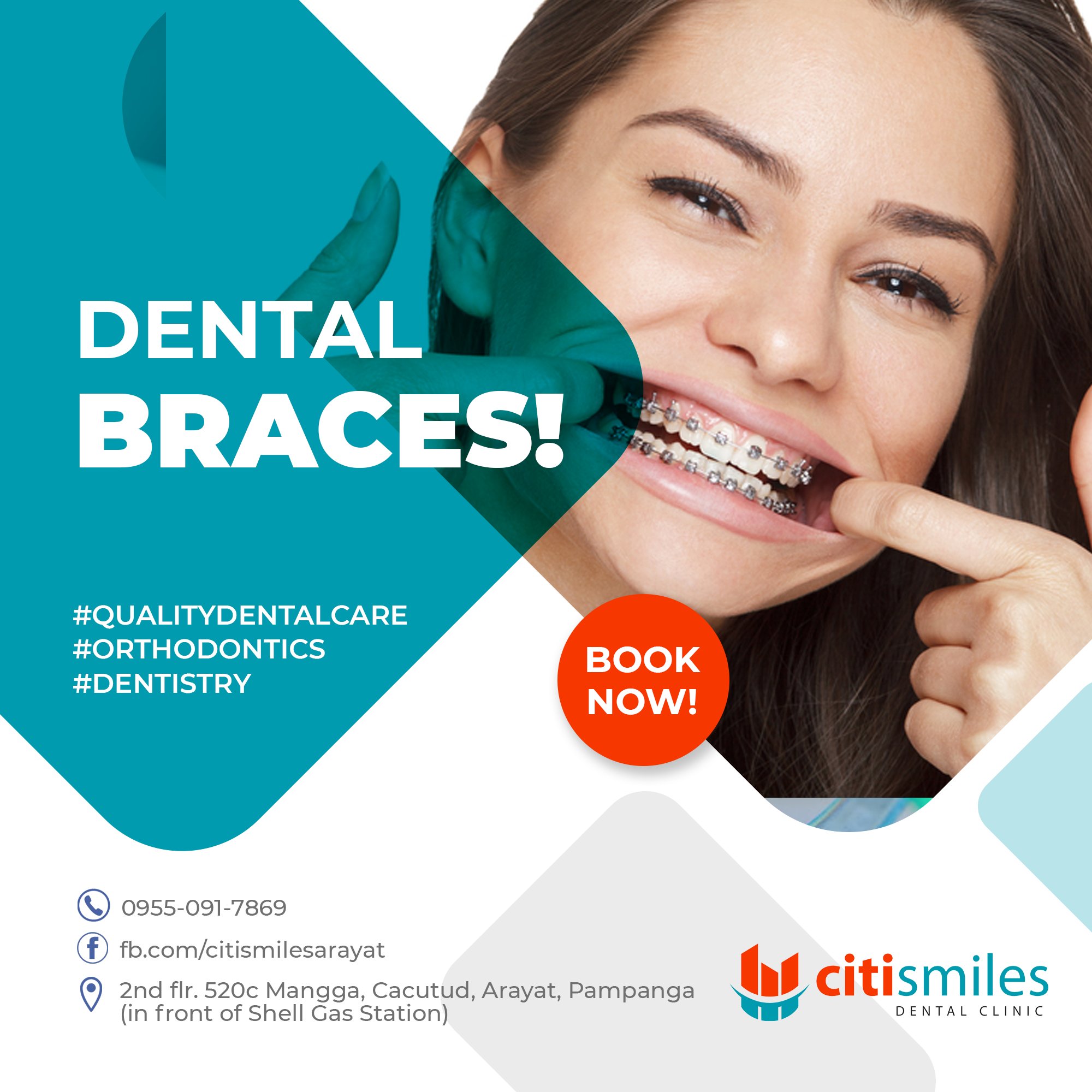 Citi Smiles Dental Clinic - Arayat, Pampanga Facebook ad: Dental braces are a way of straightening crooked…