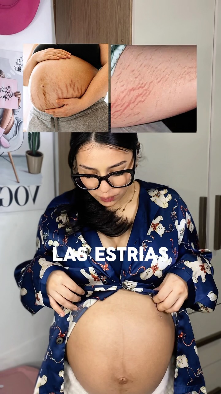 Arencia Global Facebook ad: Sabias que la Vit C estimula el COLAGENO…