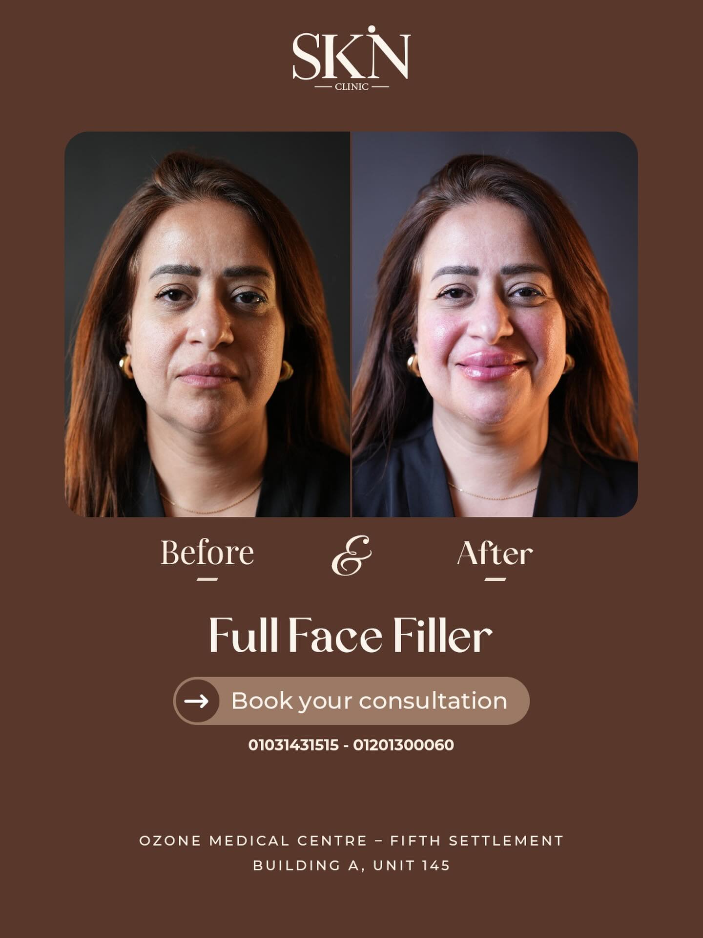 SKiN Clinic Facebook ad: One treatment. Complete harmony.