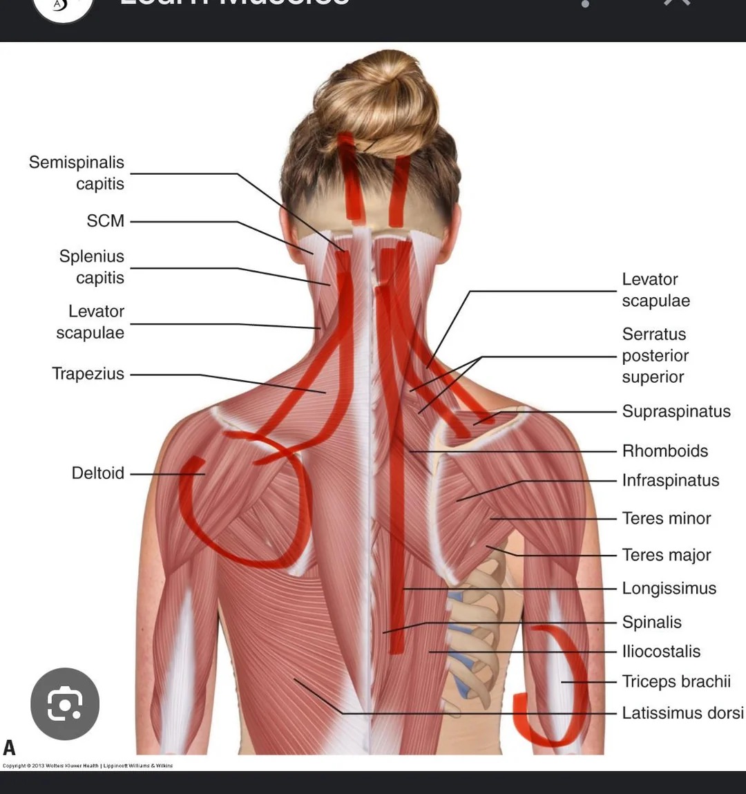Susan Collins - The Neck & Shoulder Pain Community Facebook ad