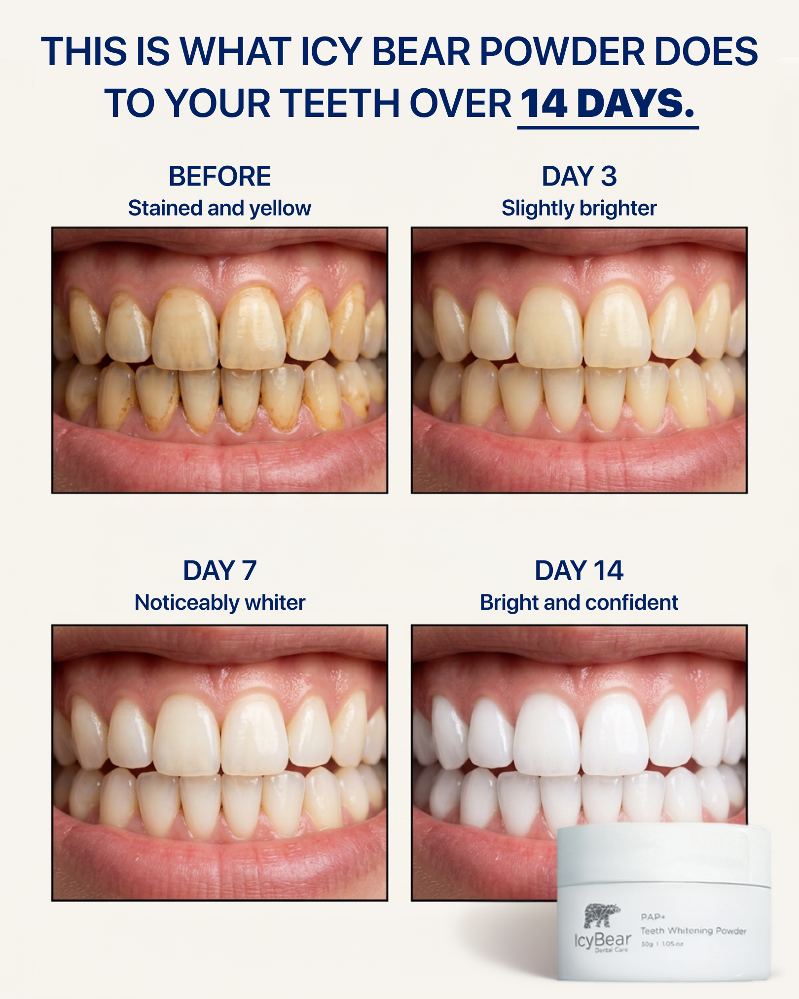 Icy Bear Dental Facebook ad