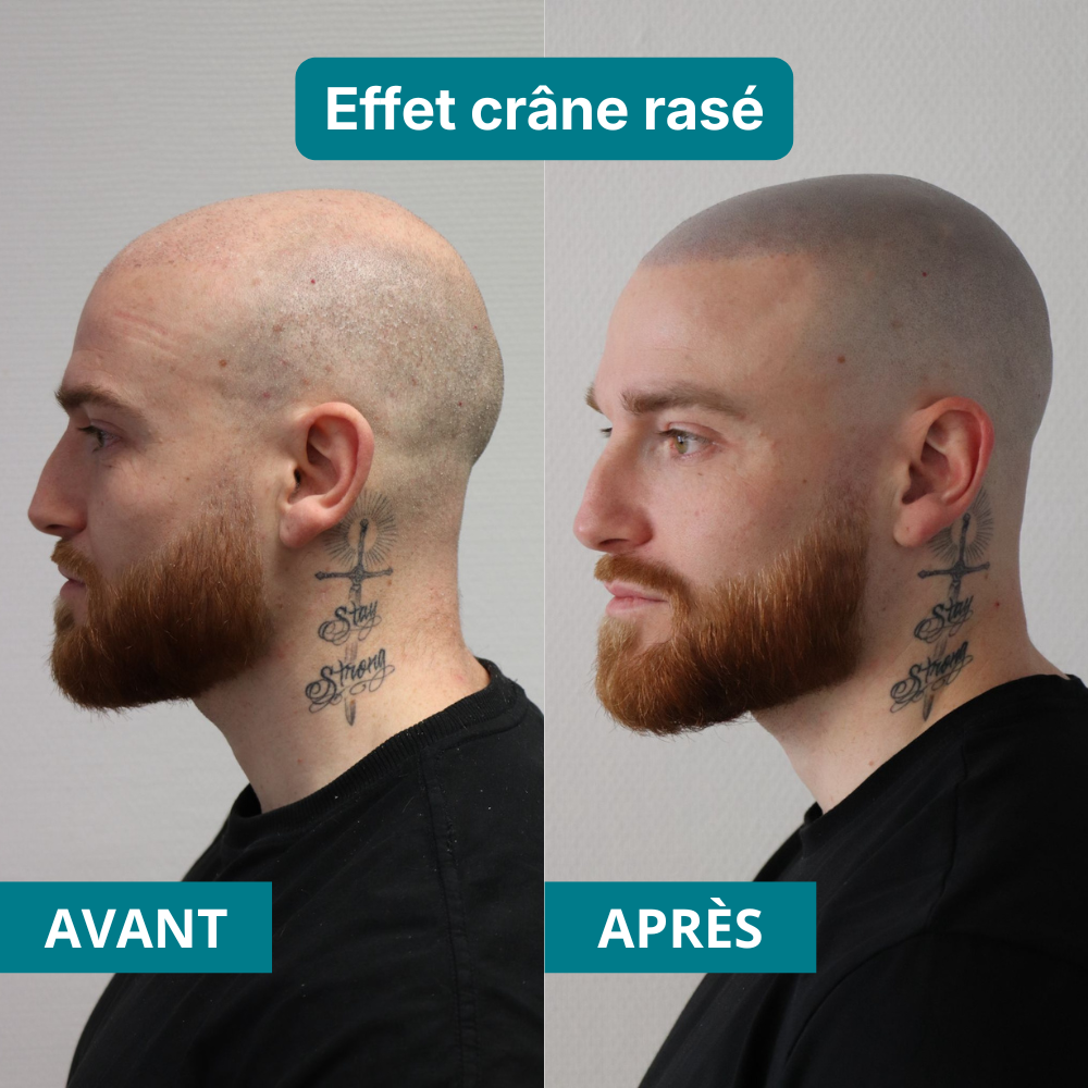 Scalp-Hair Clinic Facebook ad