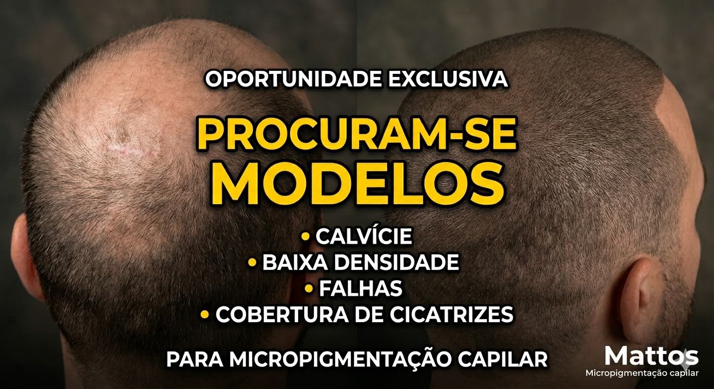Mattos Micropigmentação capilar Facebook ad: OPORTUNIDADE: PROCURAM-SE MODELOS PARA MICROPIGMENTAÇÃO…